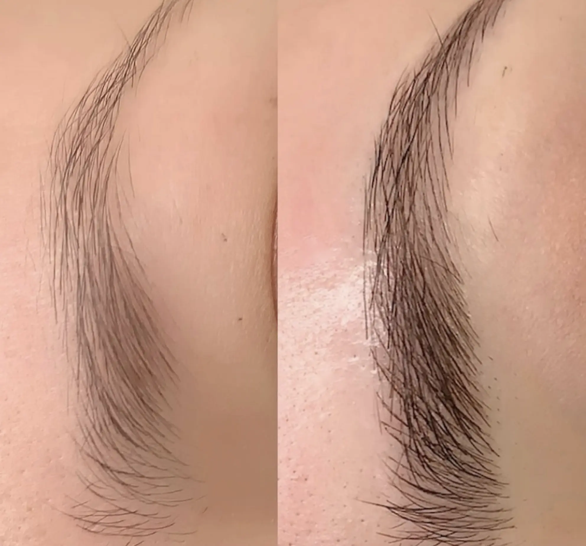 Common Mistakes to Avoid with Eyebrow Microblading