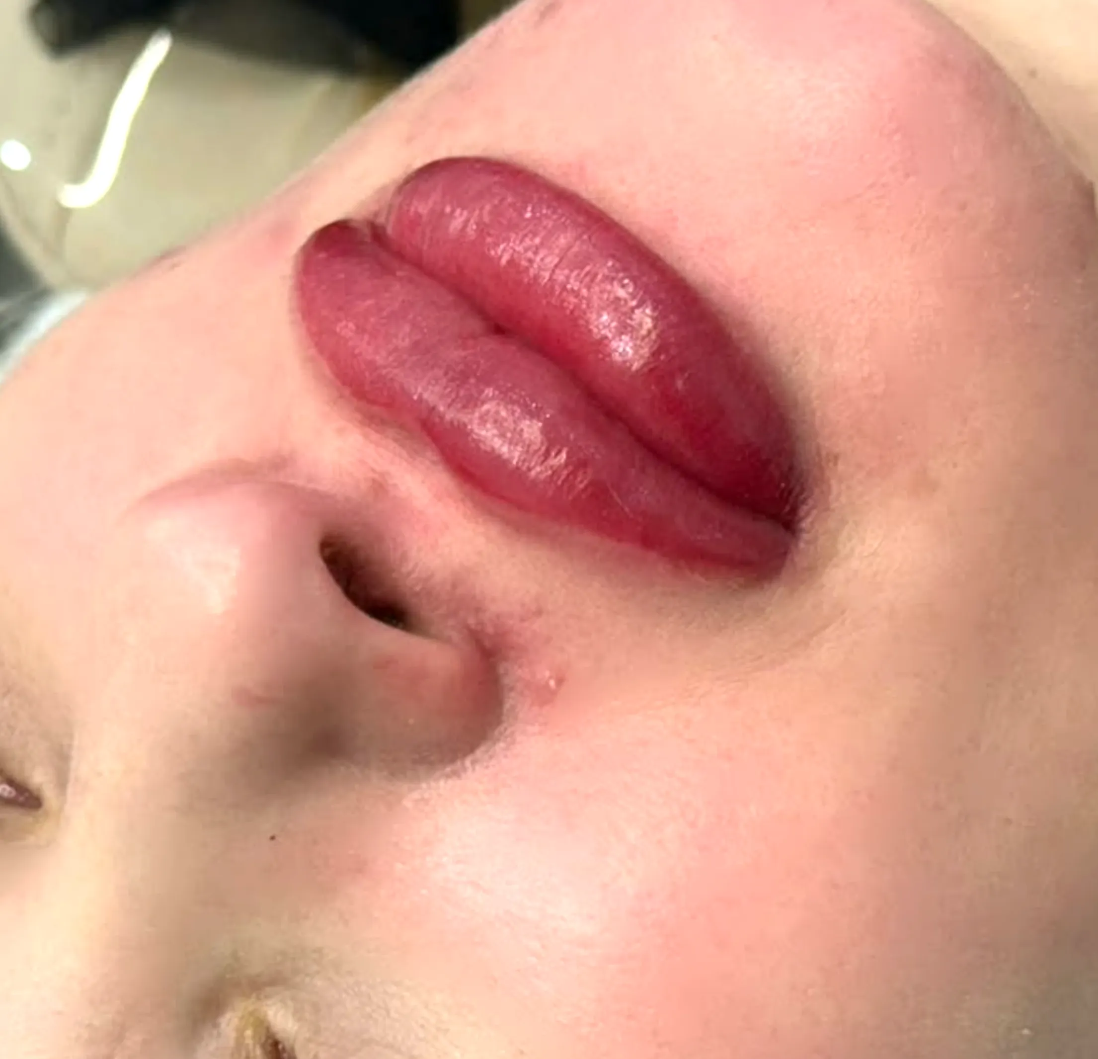 cosmetic tattoo training for dermal therapists